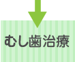 むし歯治療